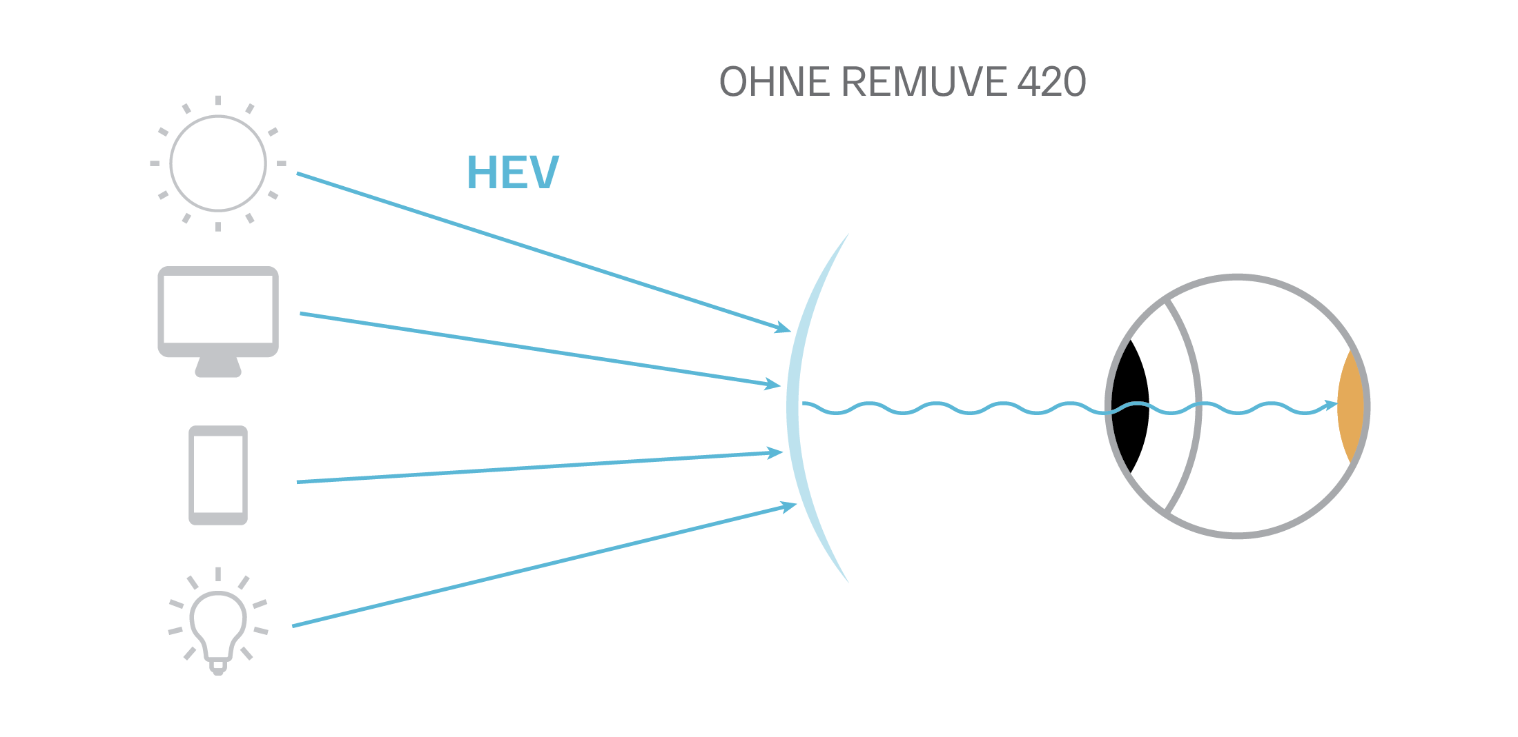 remuve